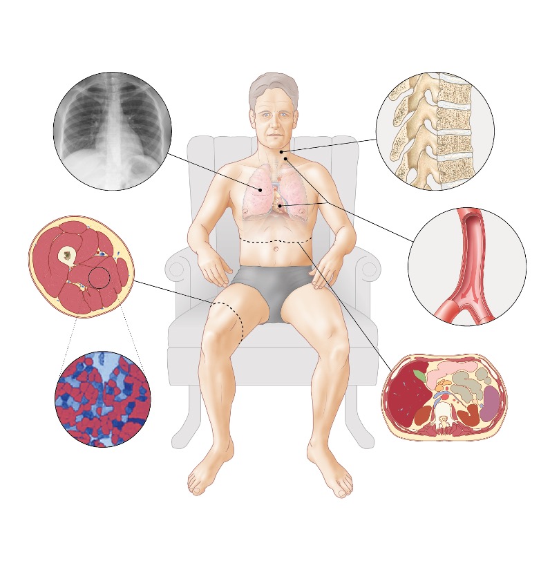 A metabolic perspective on respiratory disease