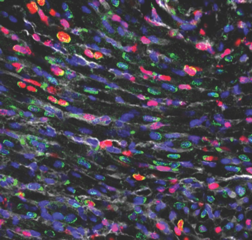 heart cells