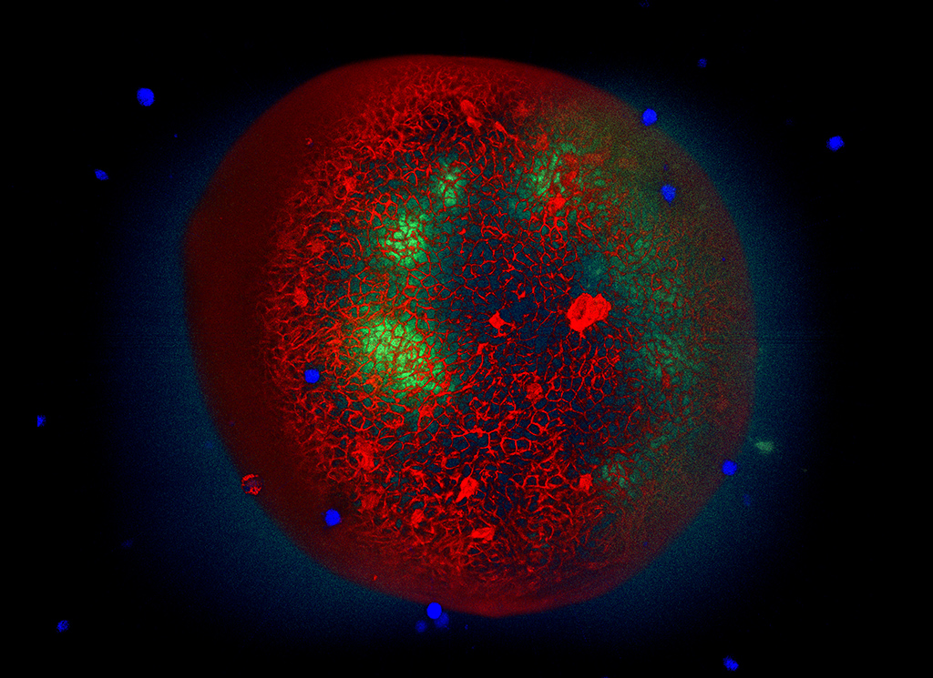 Lung Organoid imaged by spinning disk microscopy
