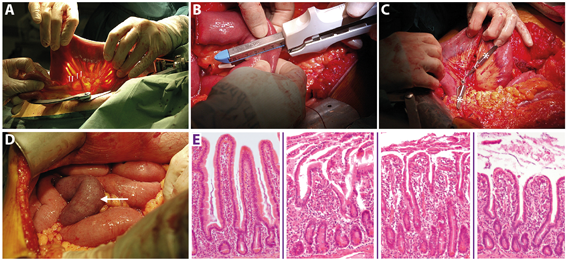 Ischemia-reperfusion damage in digestive tract and liver