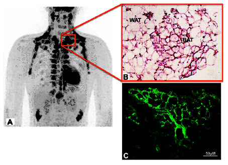 Brown adipose tissue