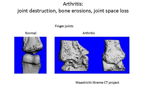 3D reconstruction