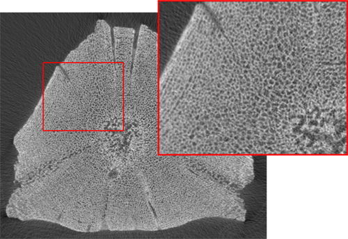 Bone micro-architecture