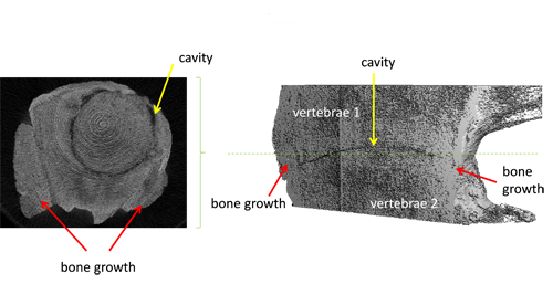 3D reconstruction of two connected vertebrae