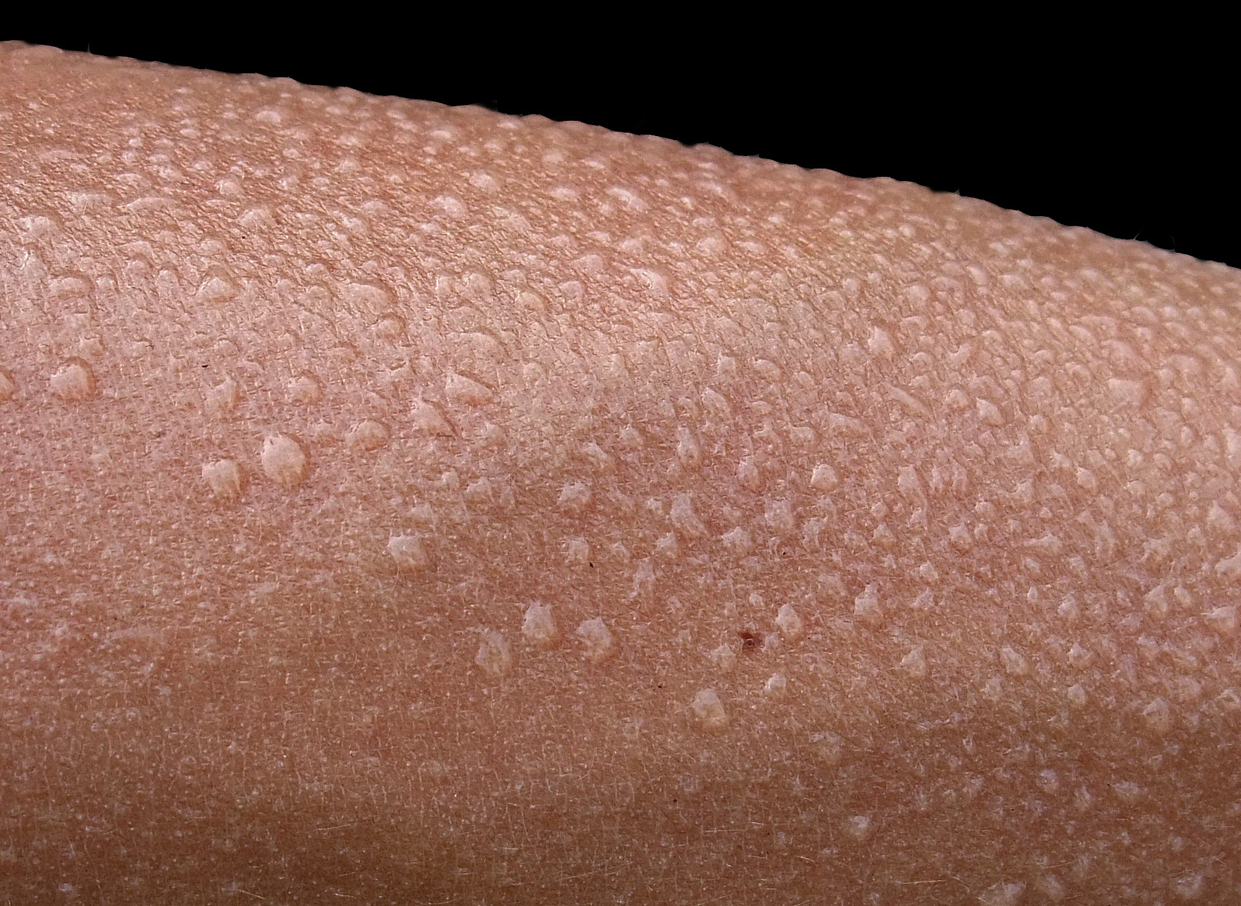Sweat