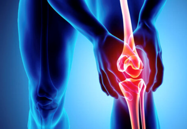 Osteoarthrititis