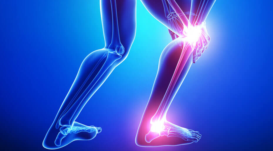 Theme Leg