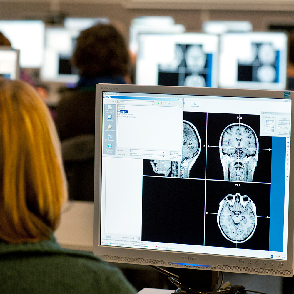 Woman looking at brain scans on computer screen