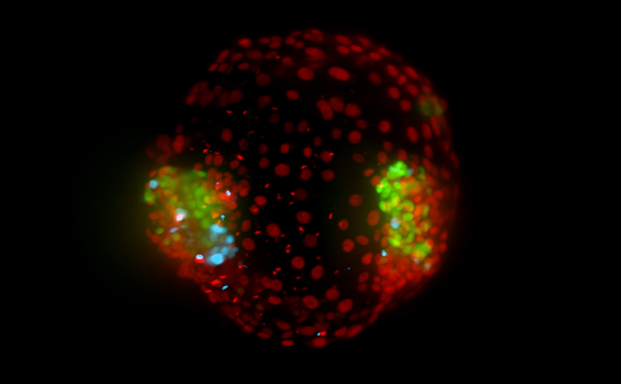 3D-opname van het synthetische menselijke tweeling-embryo