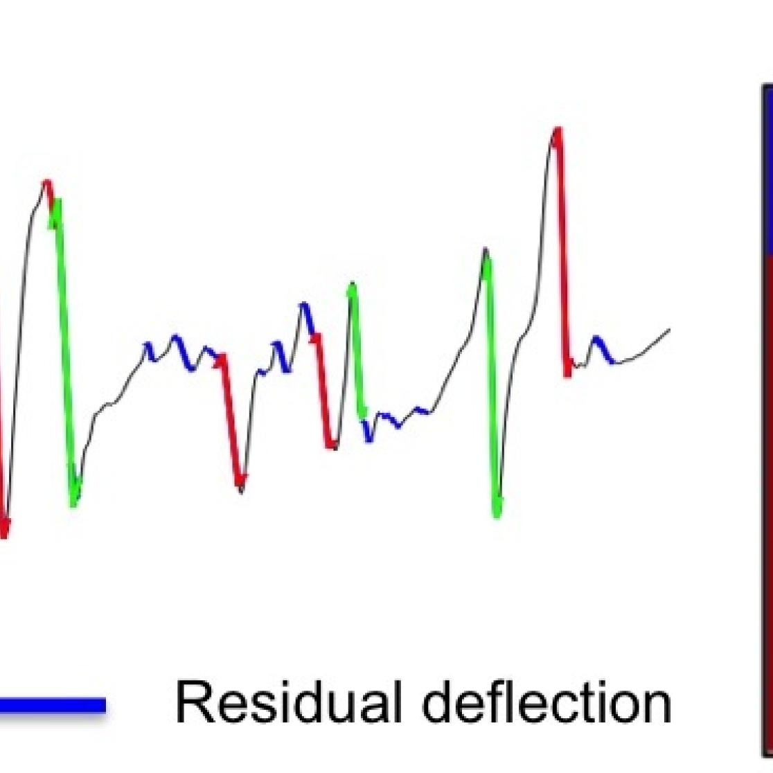 atrial_fibrillation_5