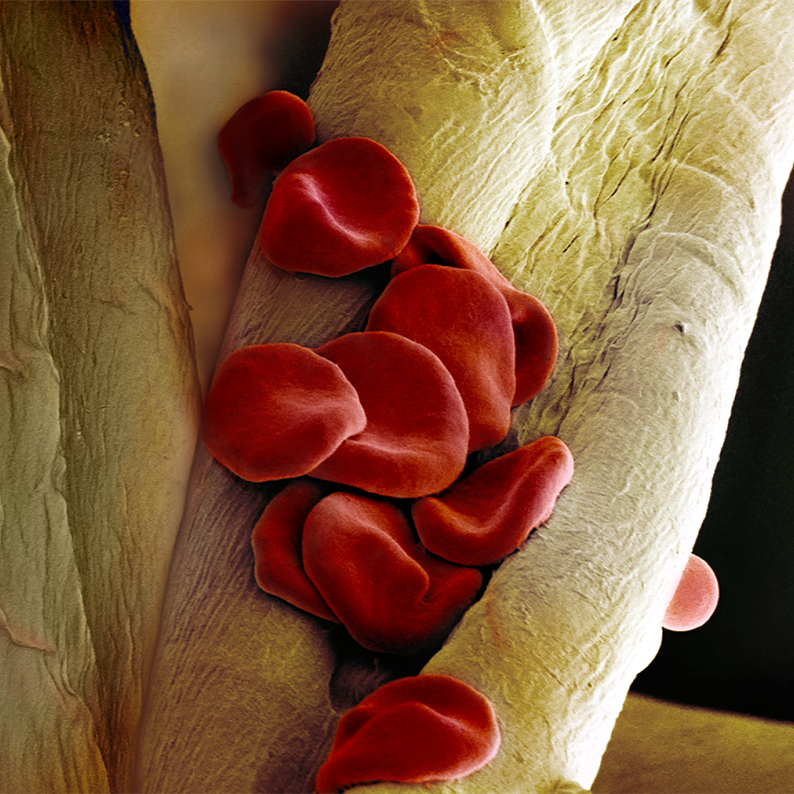 red blood cells in a microscopic image