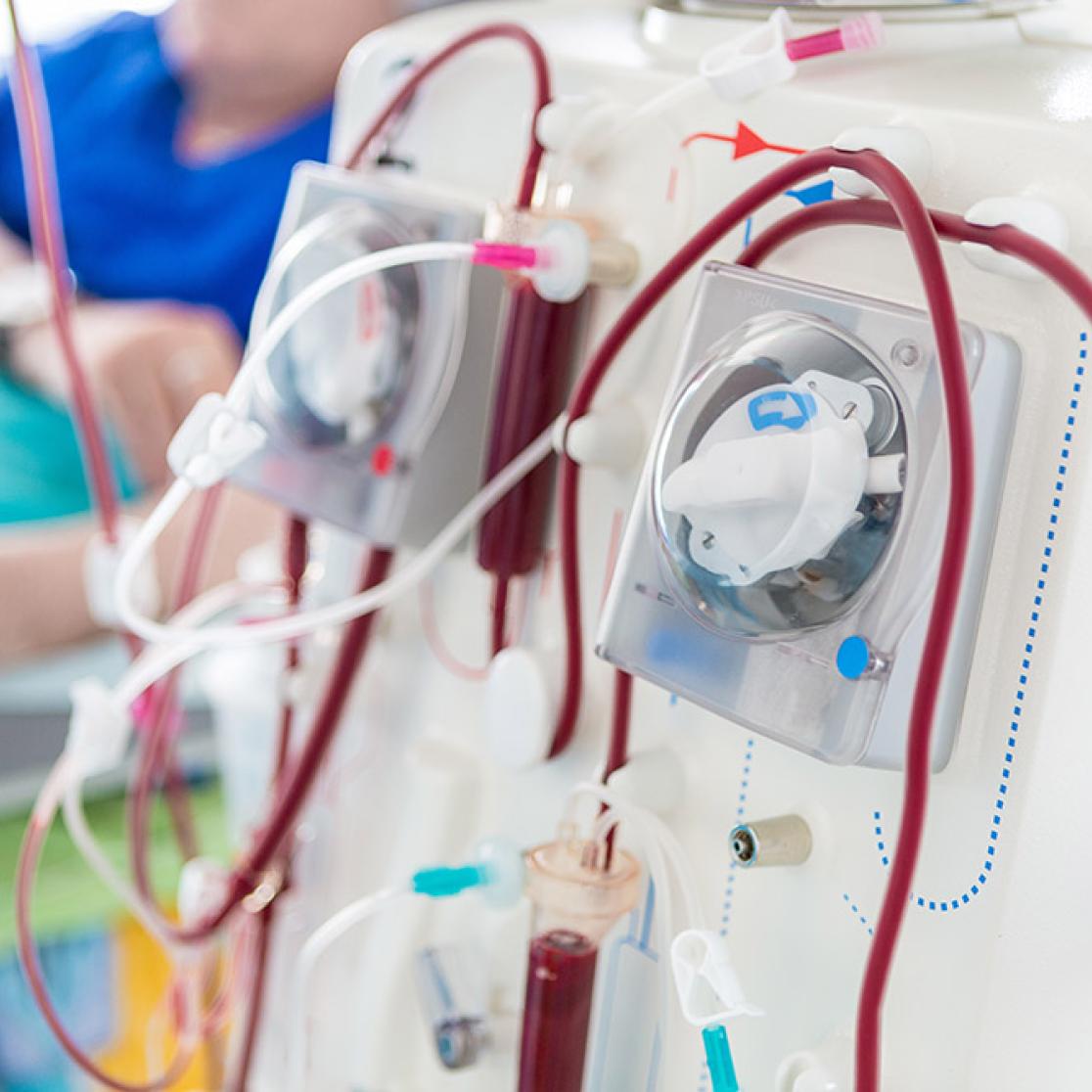 Dialysis patient in a hospital