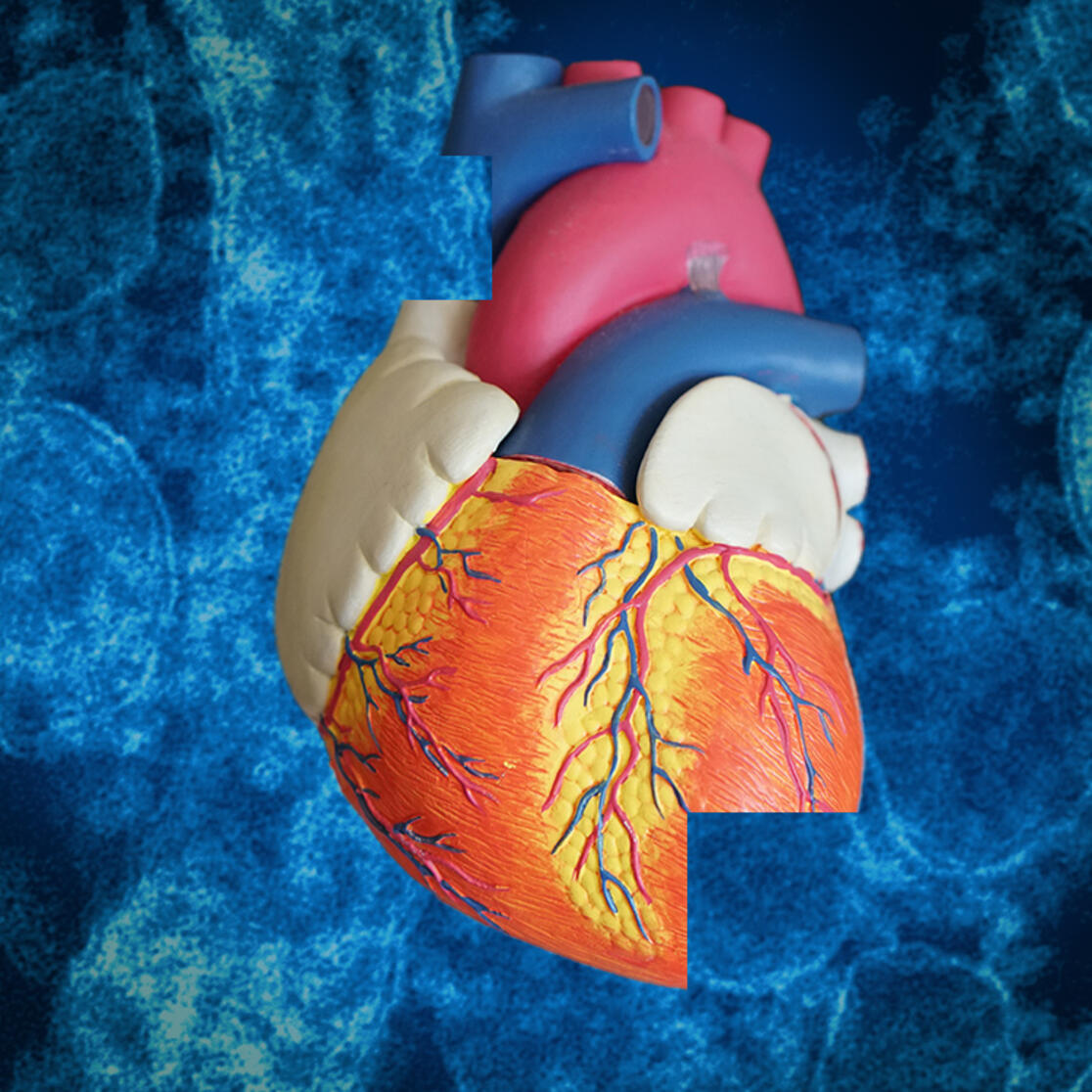 Cardiac regeneration