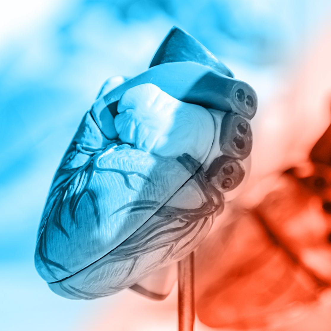 Extracellular vesicles for cardiovascular therapeutics