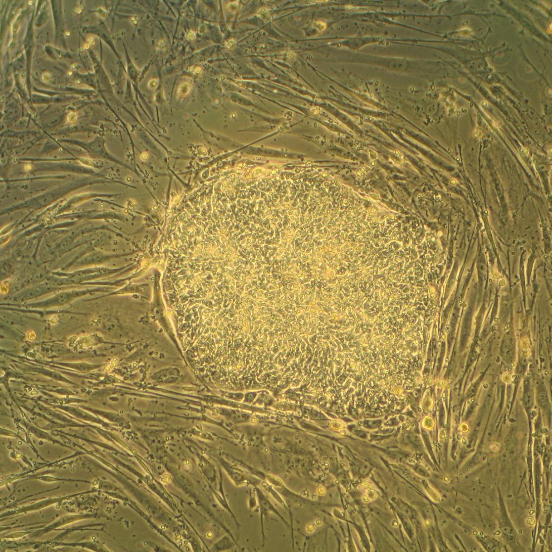 Embryonic Stem Cell