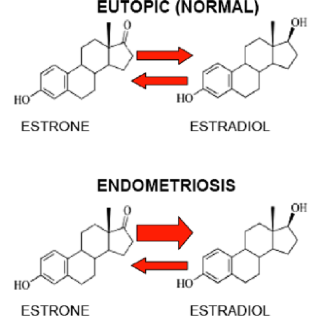 endometriosis_text_1