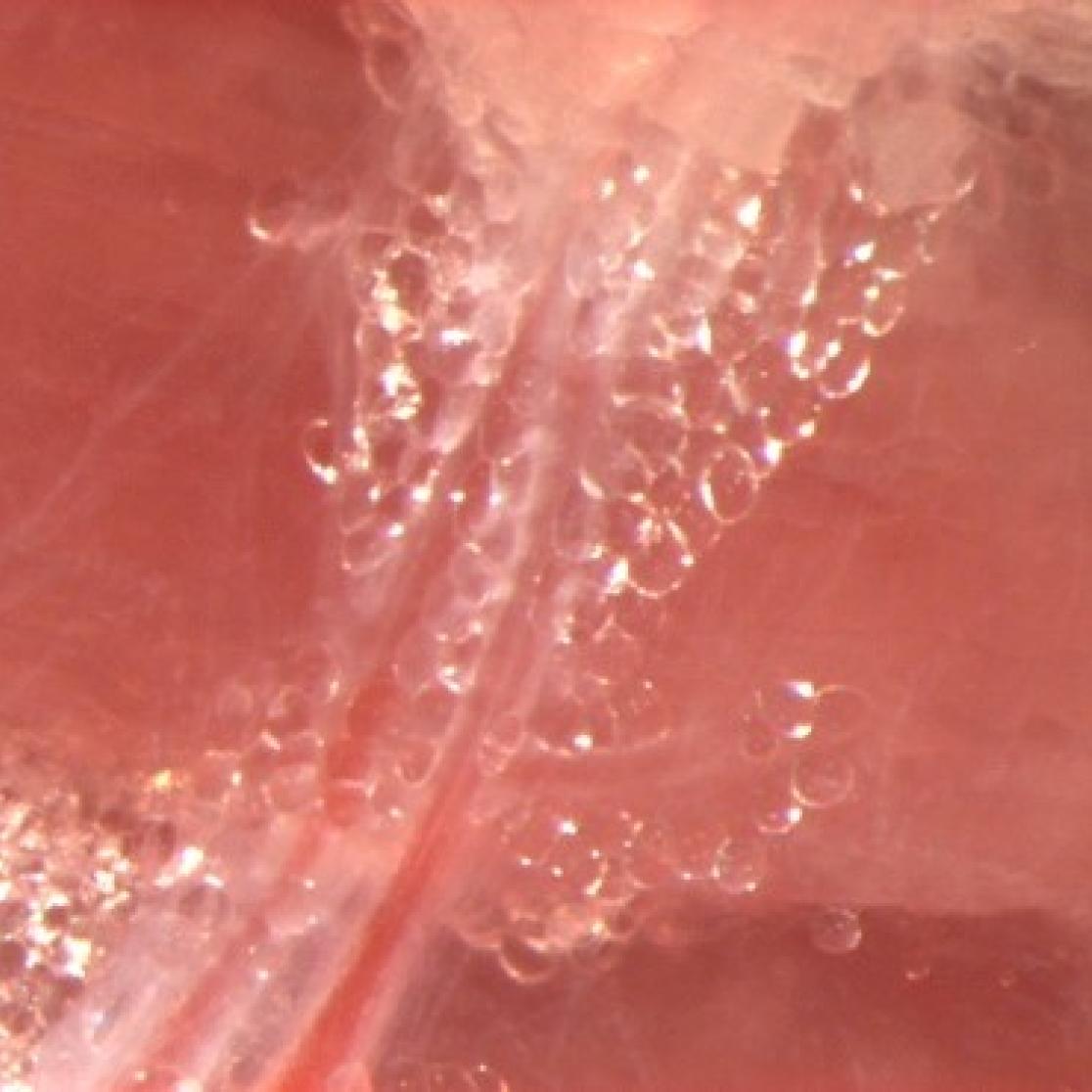 impaired_organ_blood_flow_in_obesity_and_diabetes_2