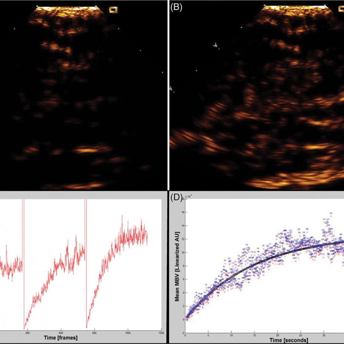 impaired_organ_blood_flow_in_obesity_and_diabetes_3