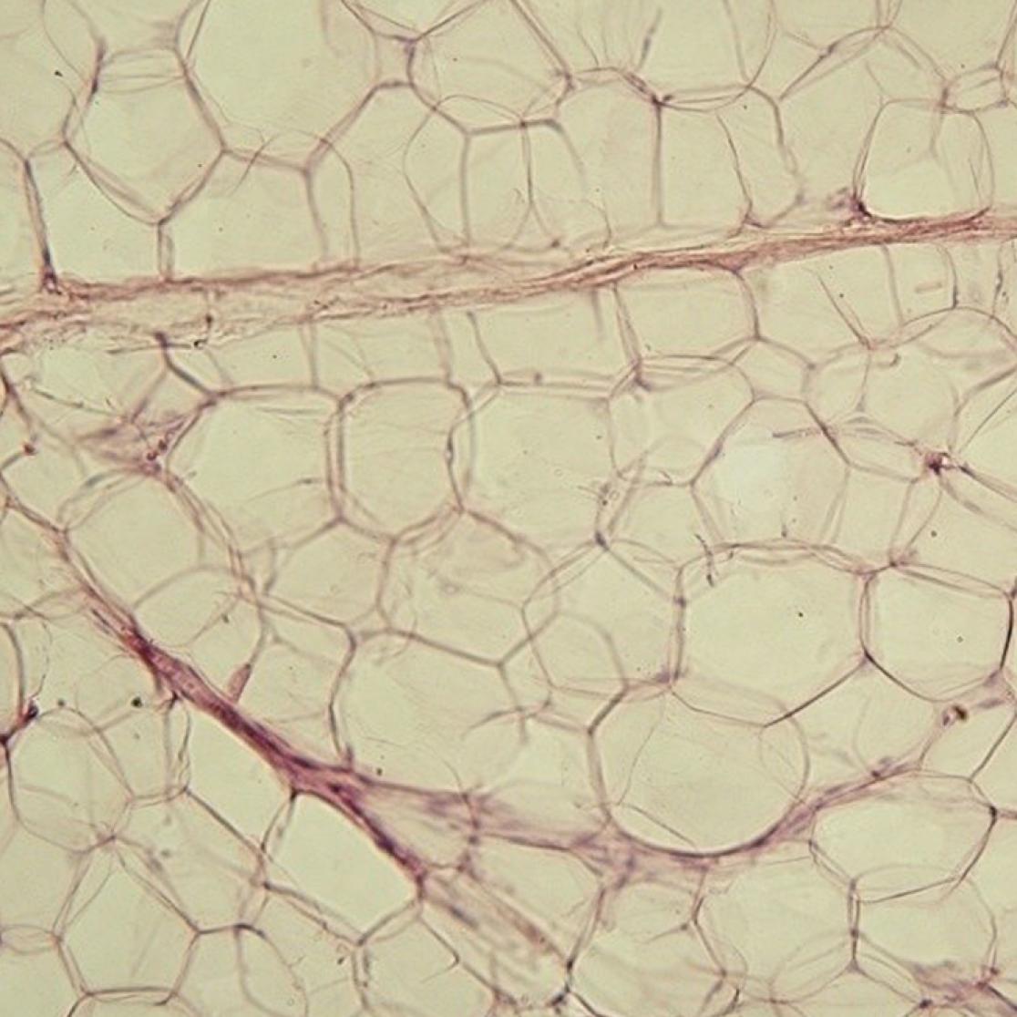 Adipose tissue