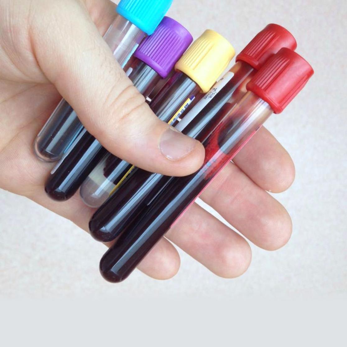 Biomarker heart attack
