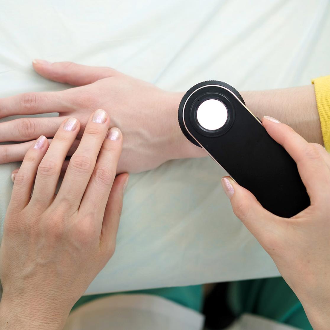 Research on a person's skin