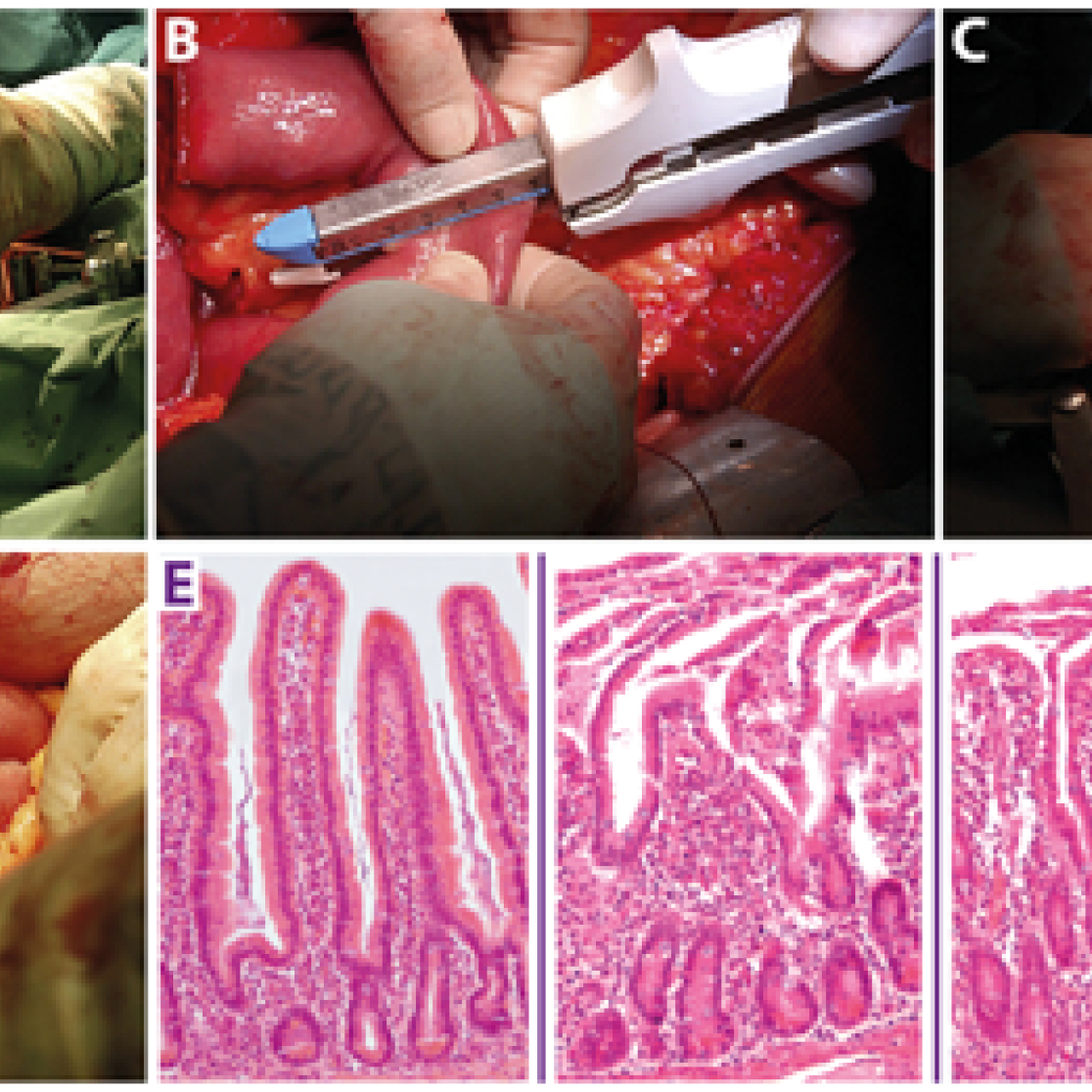 Ischemia-reperfusion damage in digestive tract and liver