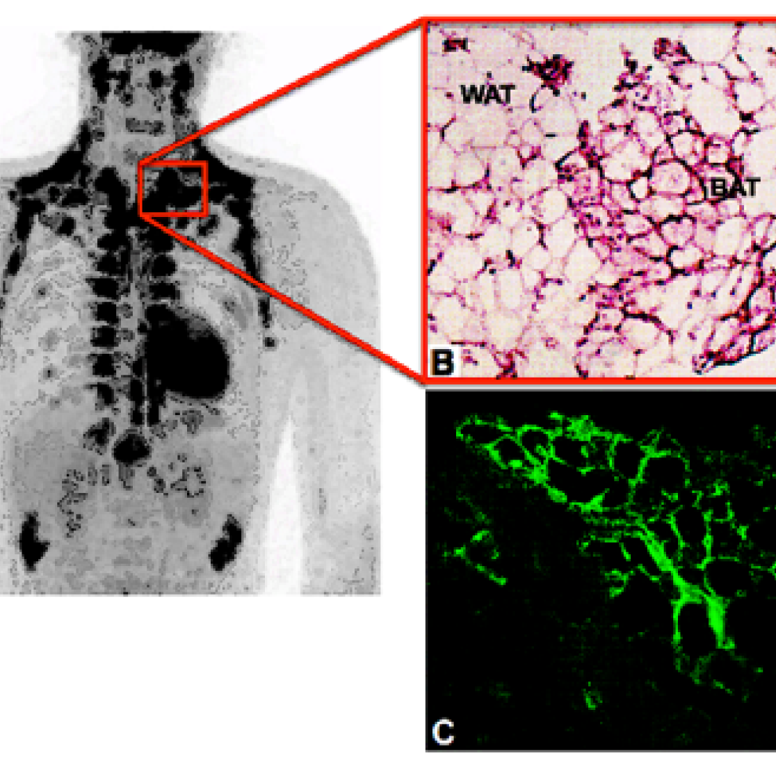 Brown adipose tissue