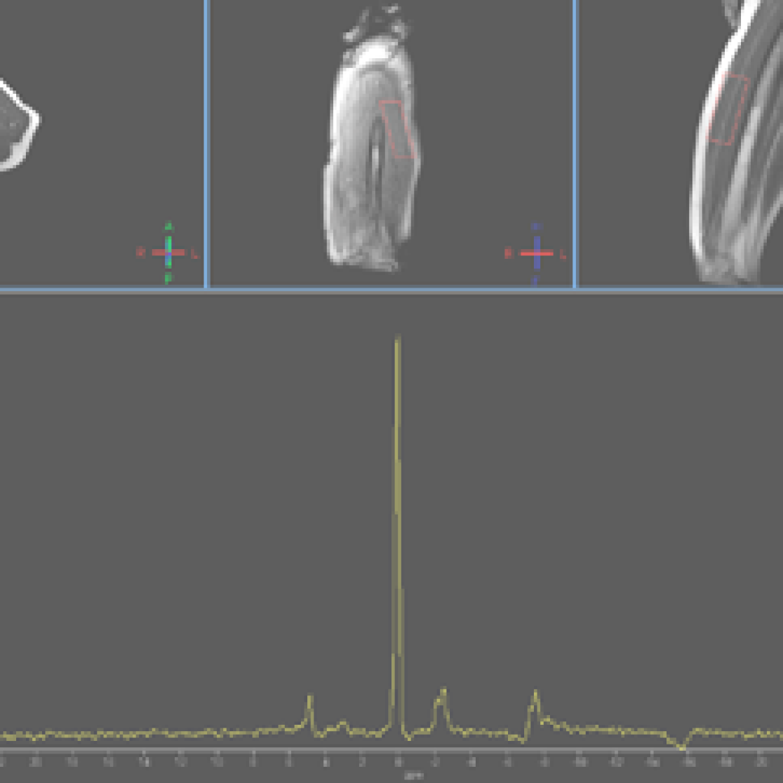Radiology