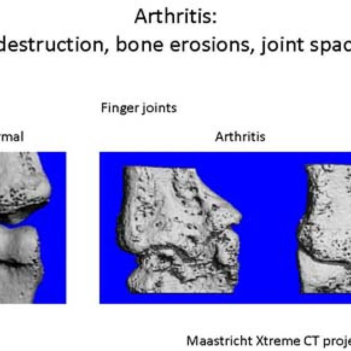 3D reconstruction
