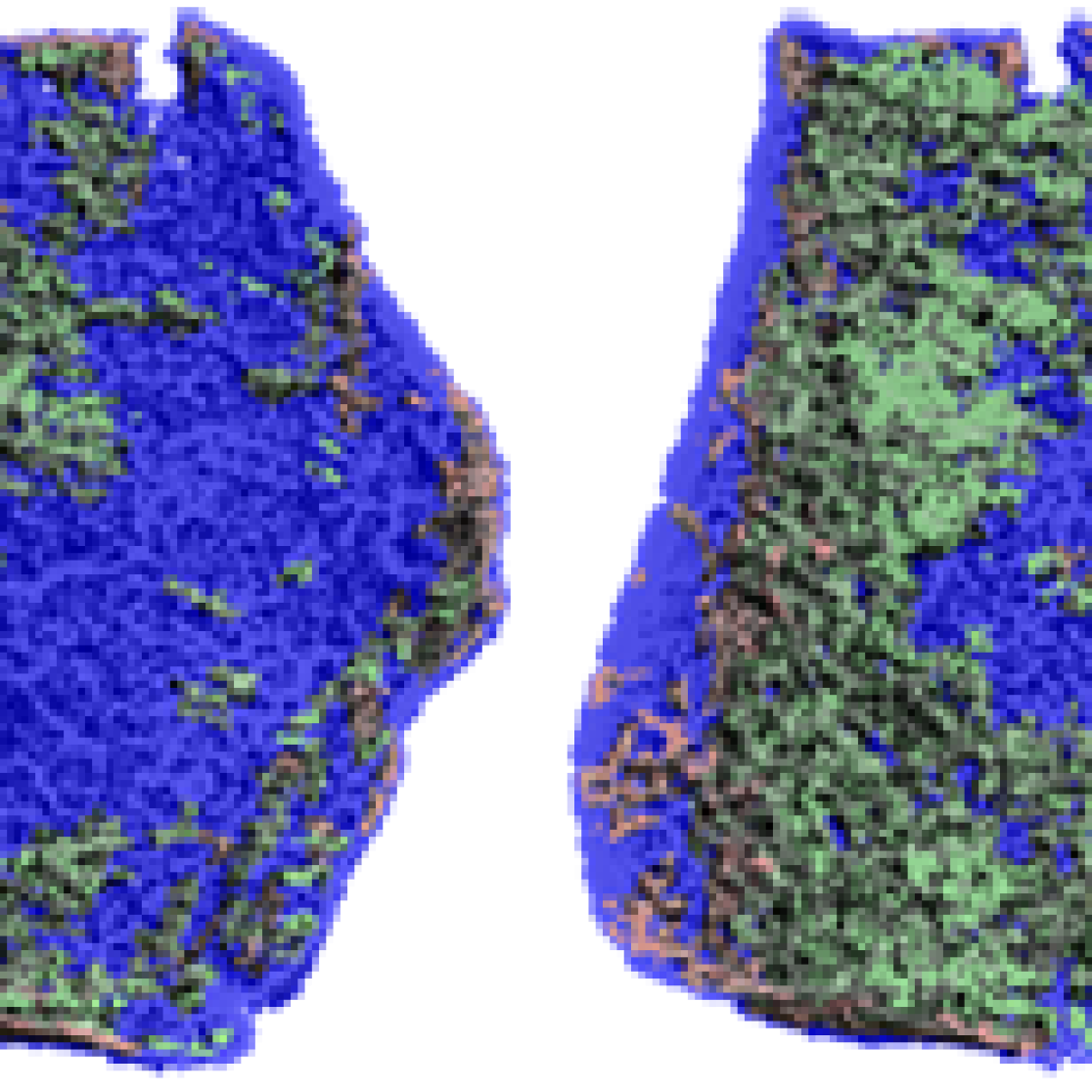 Bone gain and loss