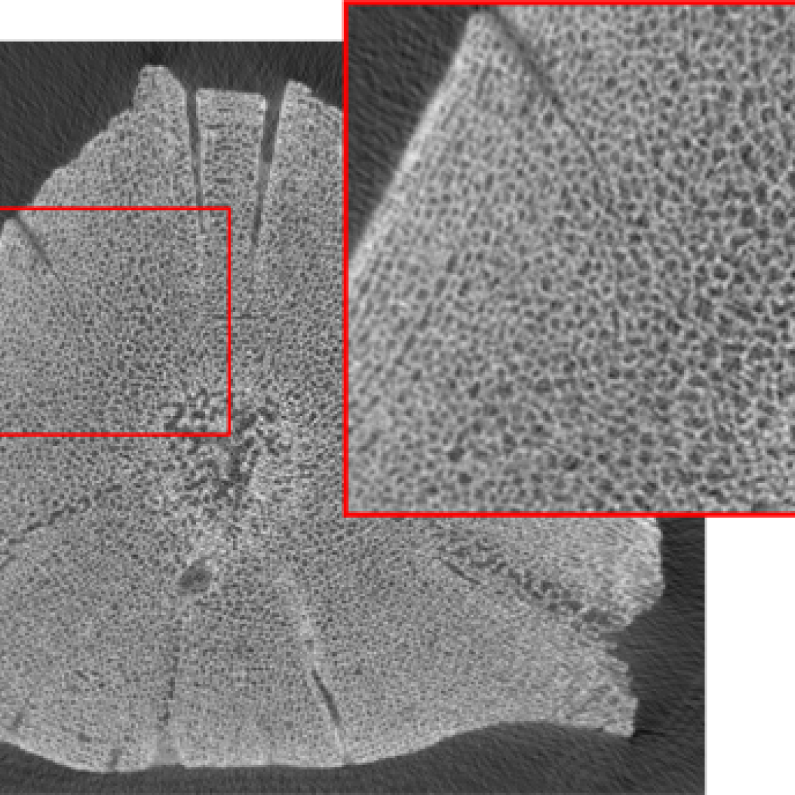 Bone micro-architecture