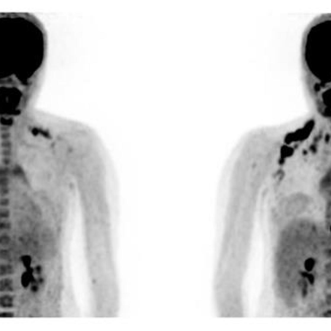umc+