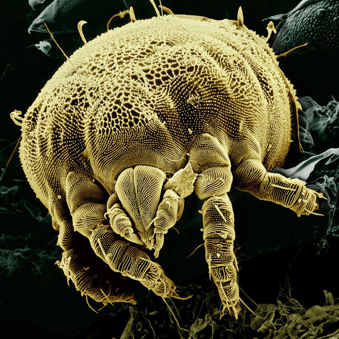 A picture of a micro organism.