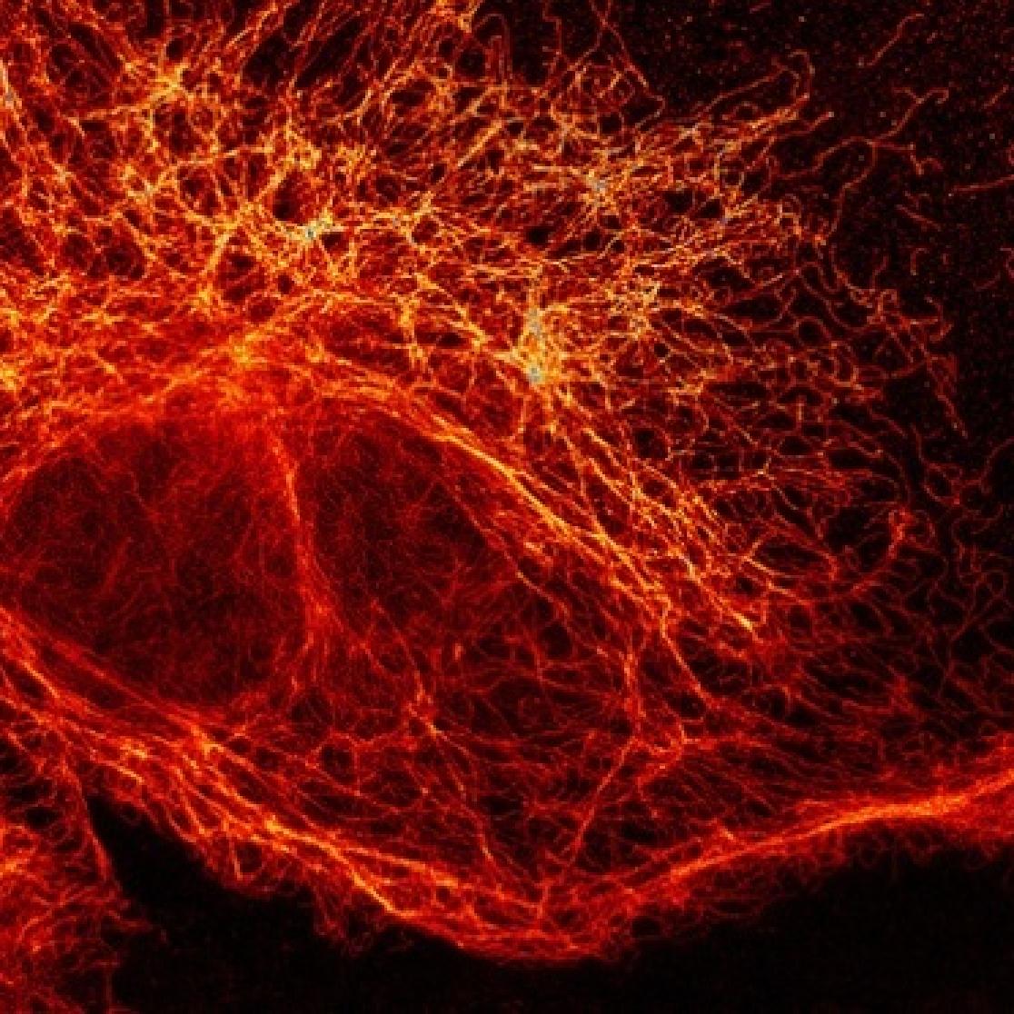 A picture of a nanoscopic recording.
