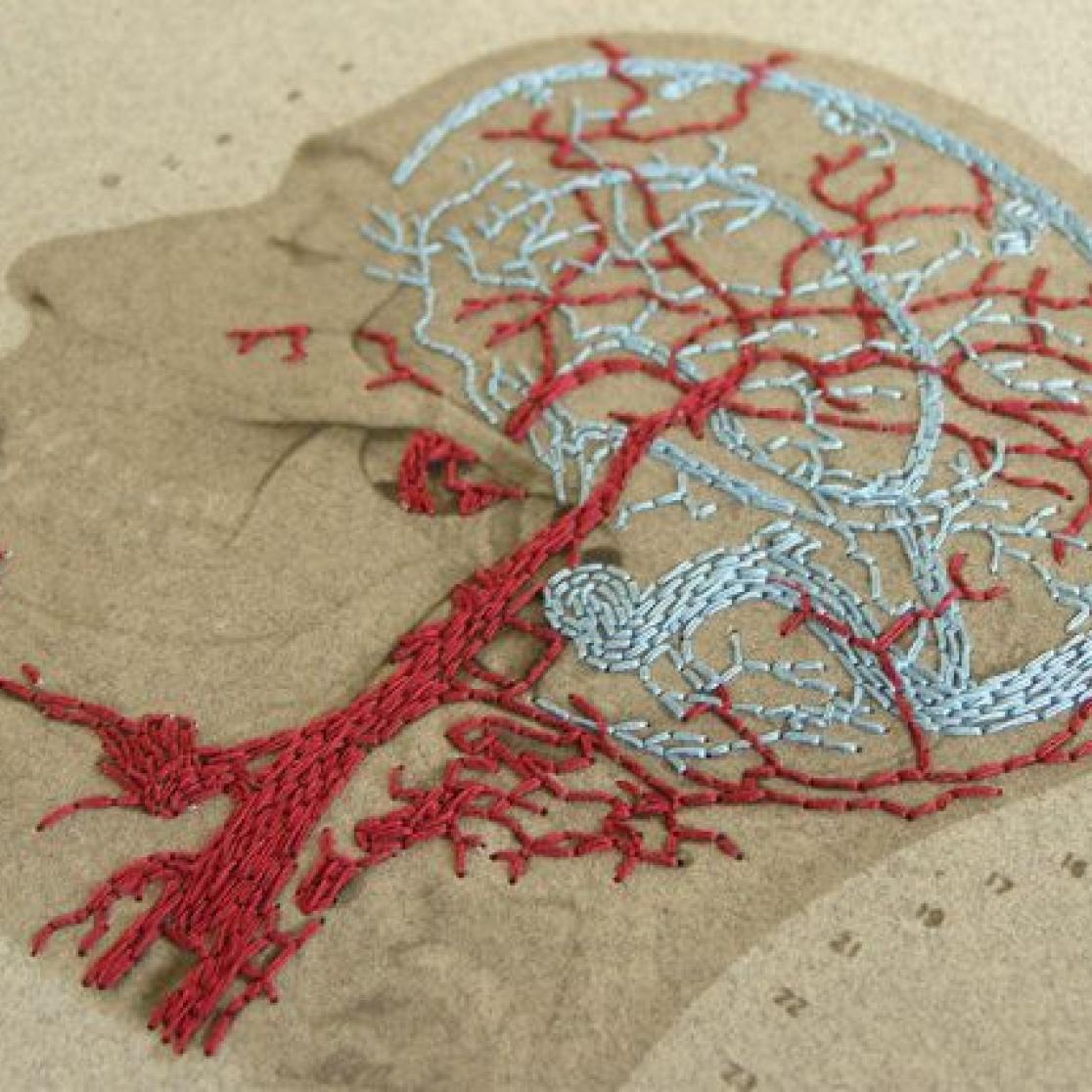 A picture of a brain and all nerves inside it