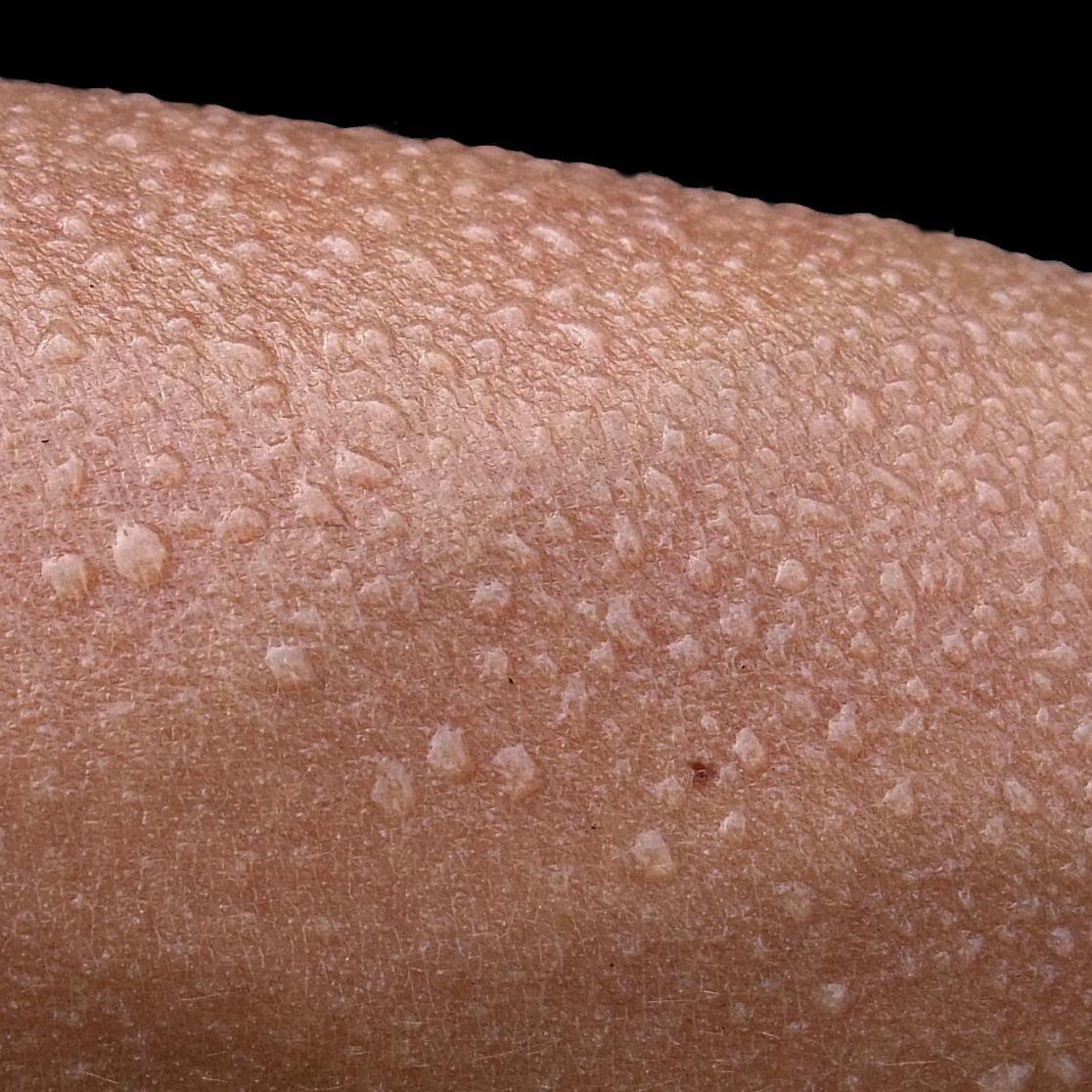 Sweat