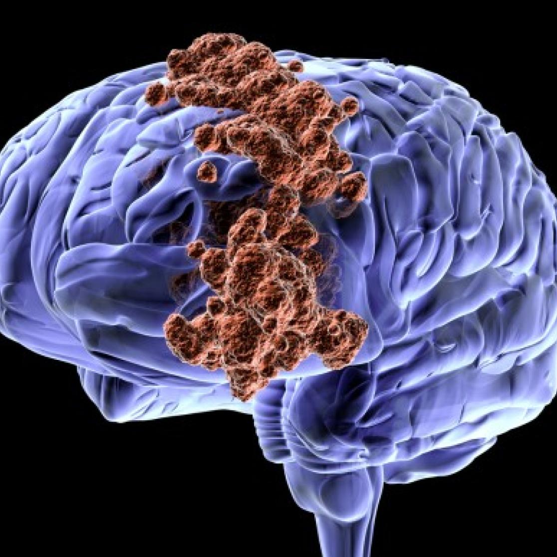 brain