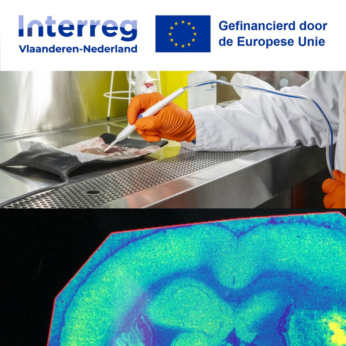iKnife for brain surgeons Interreg