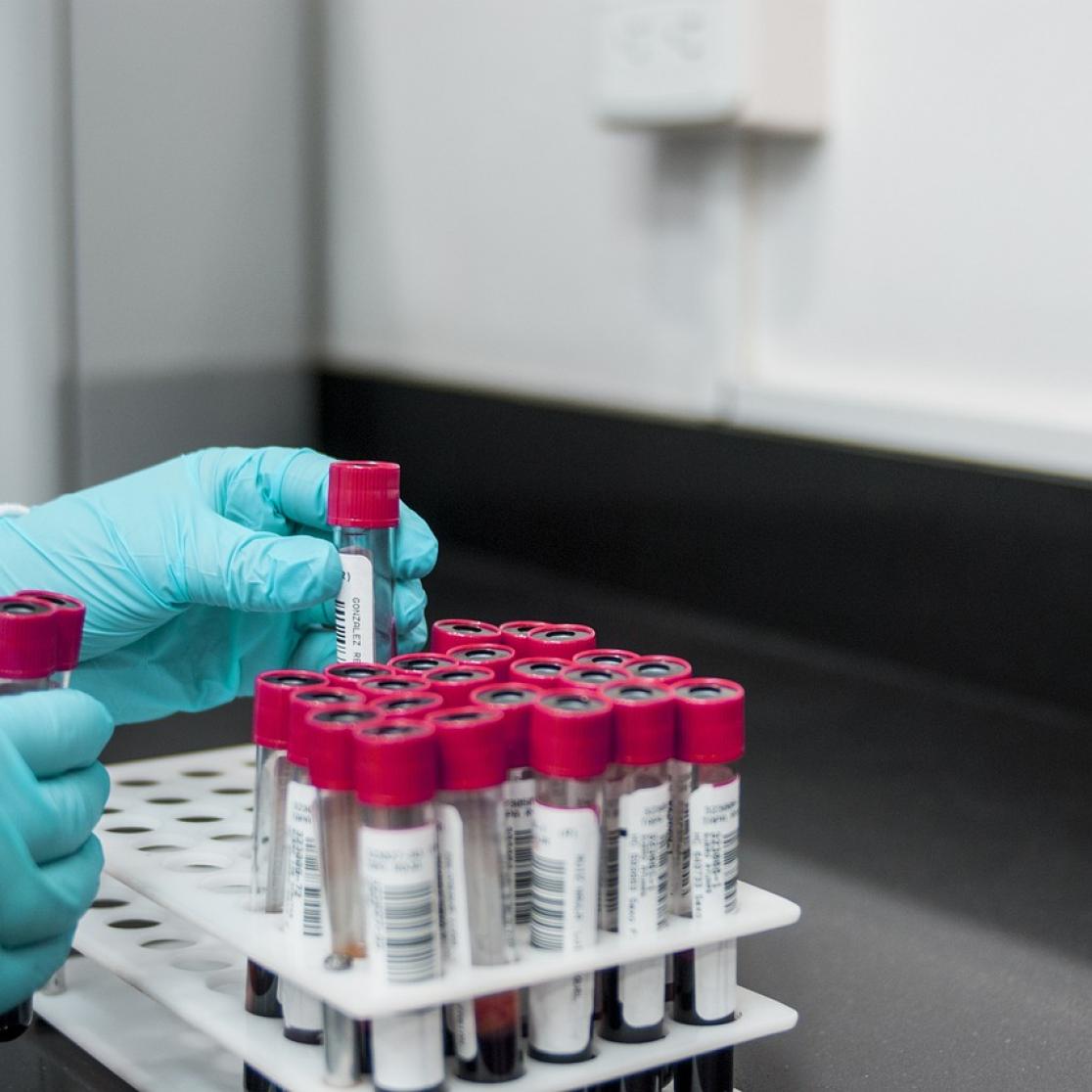 Bloedmonsters in lab