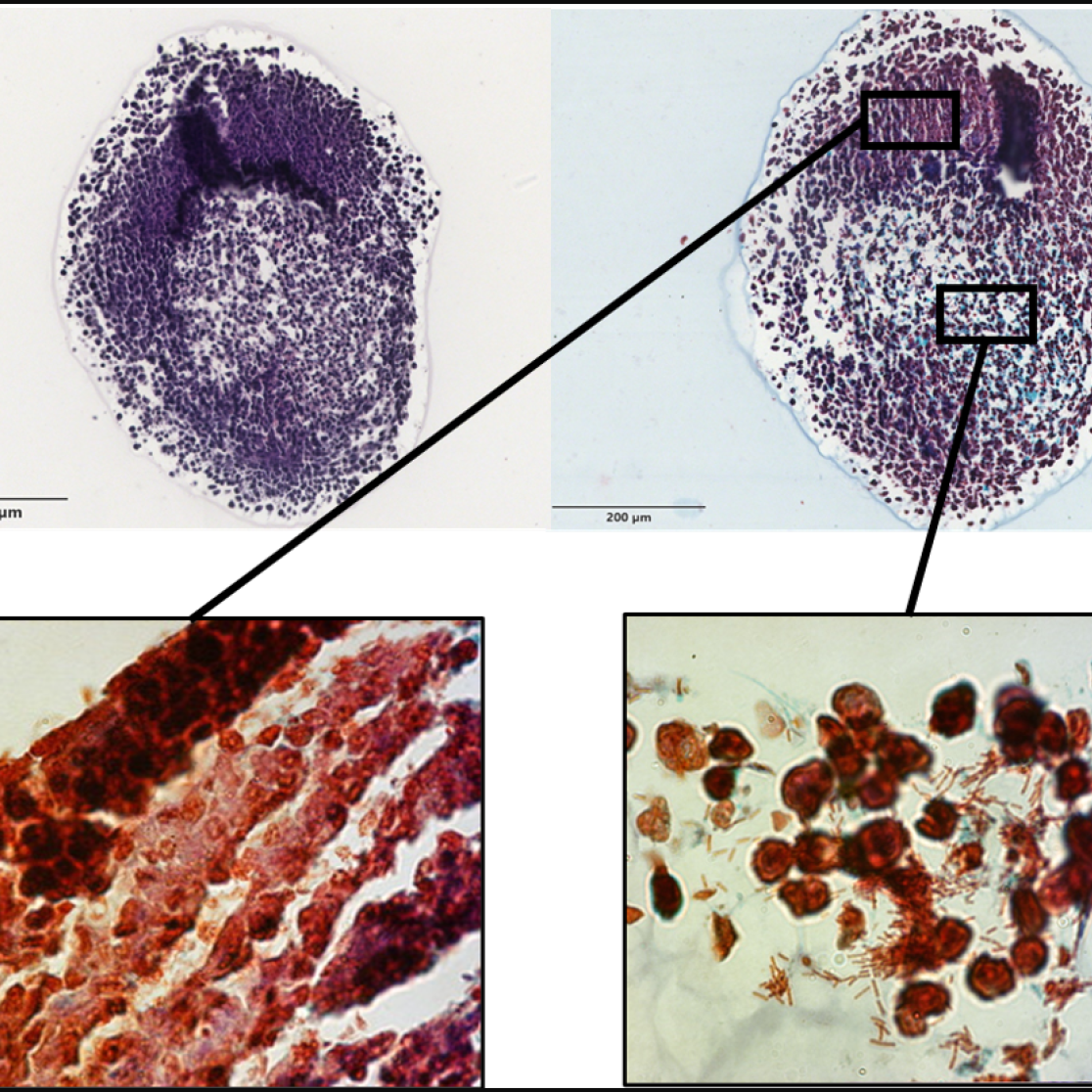 GROW tumour-targeting bacteria