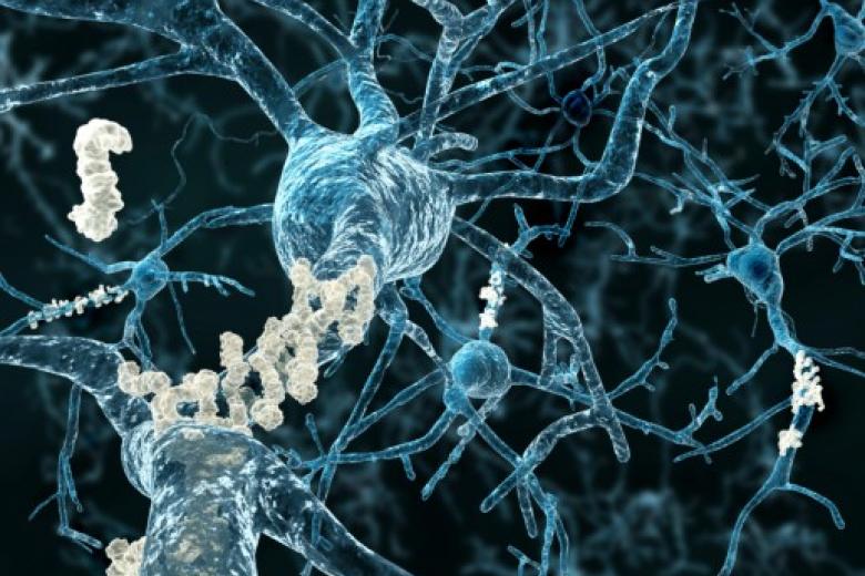 Alzheimer Plaques