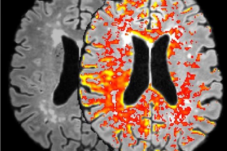 brain umc+
