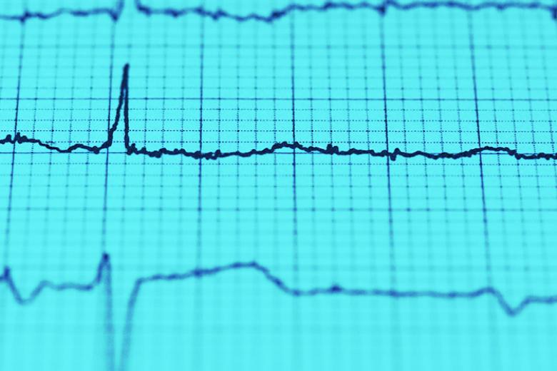Therapeutic Delivery of miR-148a Suppresses Ventricular Dilation in Heart Failure