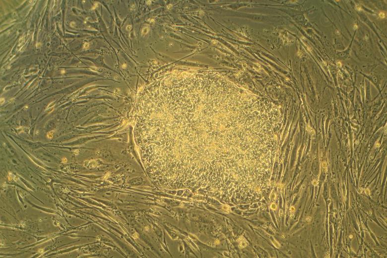 Embryonic Stem Cell