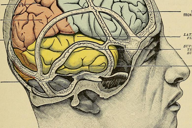 Epilepsy