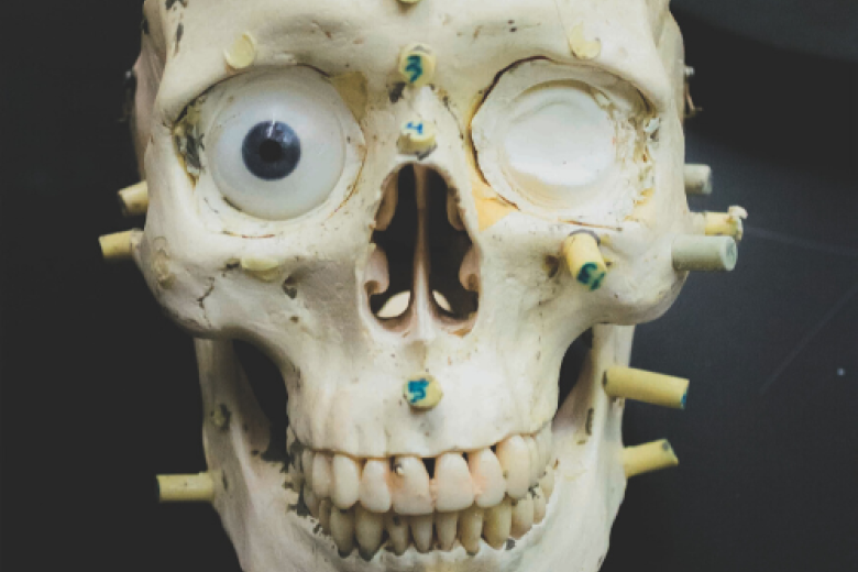 skull
