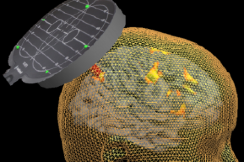 fpn_cn_bsc_scanner.png