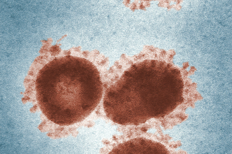 infectieziektes