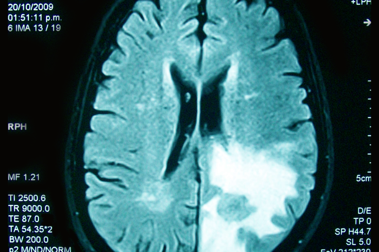 Brain