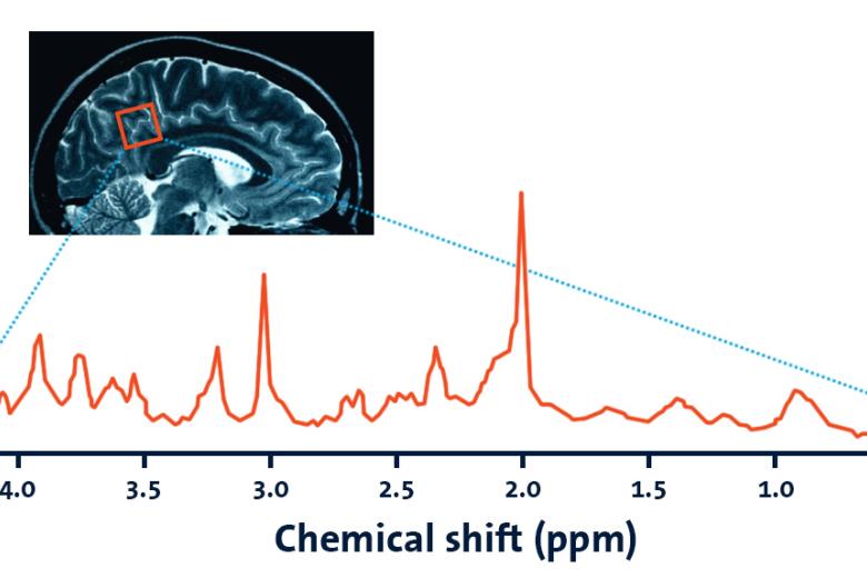 MaCSBio - Lecture series - Human MR Spectroscopy
